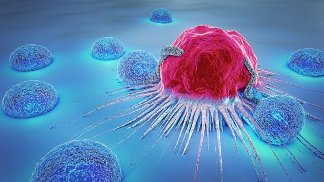 Why Cancer Resists Cure: Homeopathic Philosophy and Hering's Law