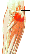 golfers-elbow-relief