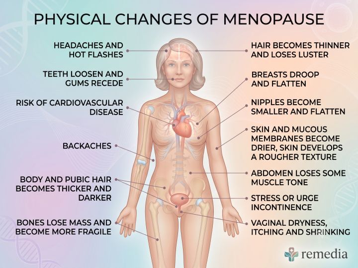 menopause-symptoms